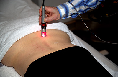 K-laser behandling
